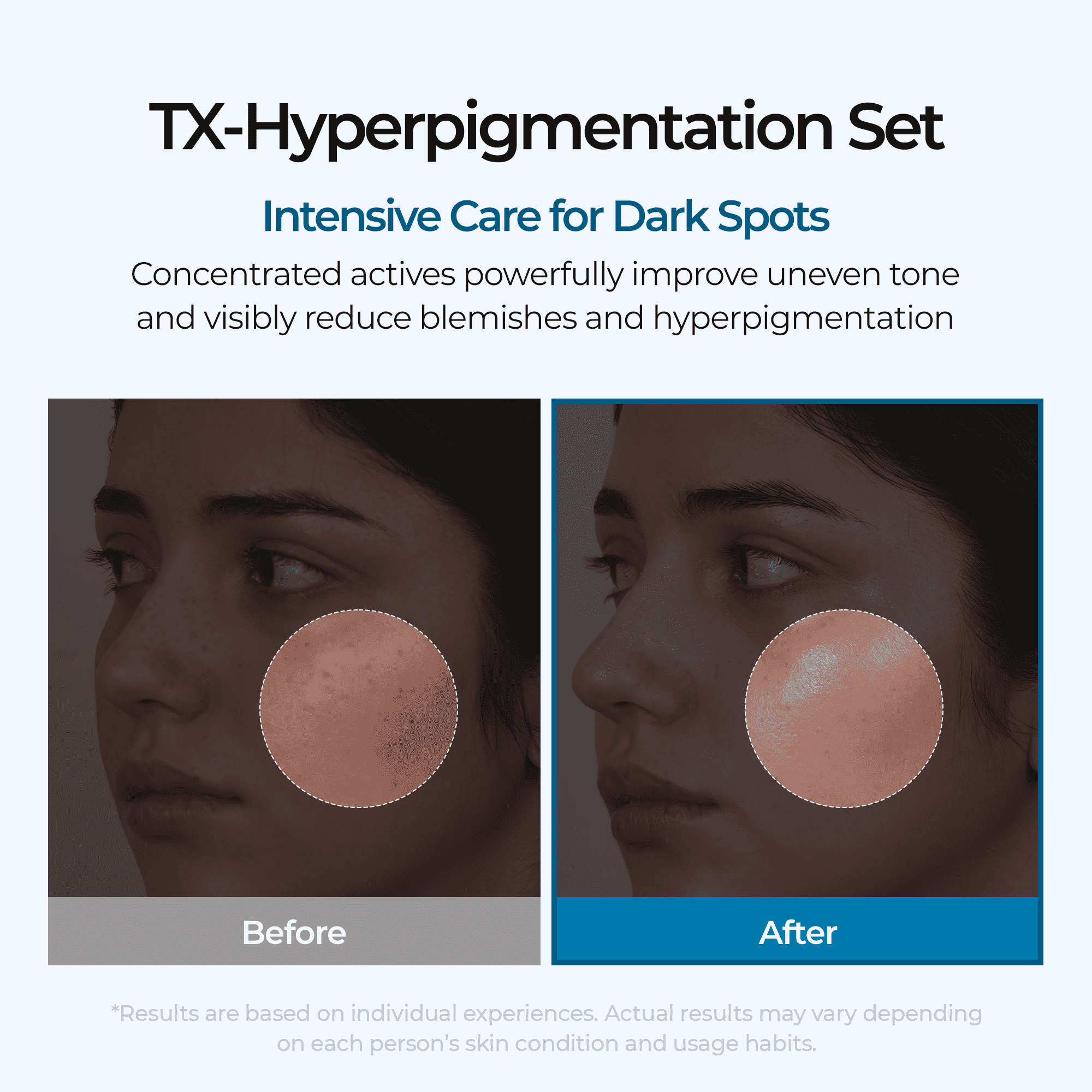 Dark Spot & Uneven Tone Peel Shot TX Duo - image 3
